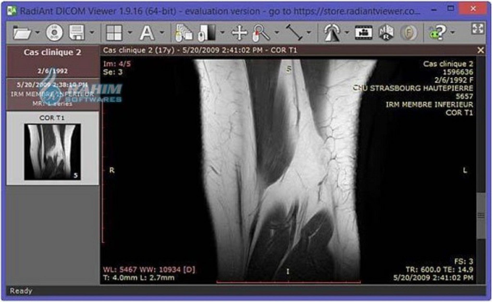 download the last version for iphoneSante DICOM Viewer Pro 14.0.1