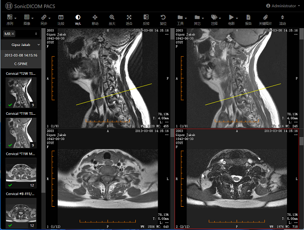SonicDICOM PACS 3.17